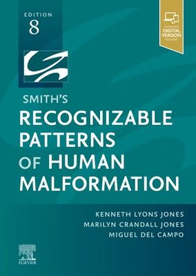 预订 smiths recognizable patterns of human malformation
