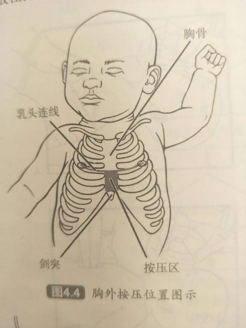 胸廓的安放位置:胸骨下1/3,位置在乳头连线和剑突之间(避开剑突).