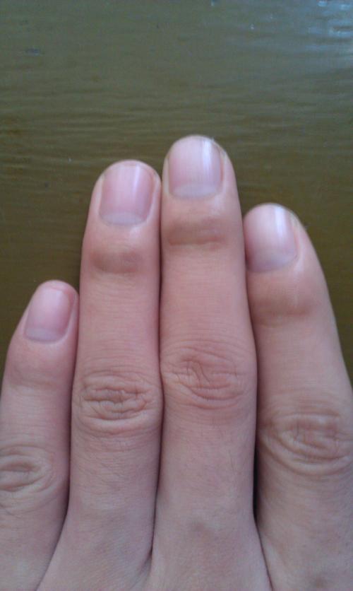 手指指甲后面第一个关节发黑