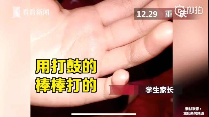 重庆一所小学的学生家长反映,孩子在课堂上被老师打手心,手掌又红又肿