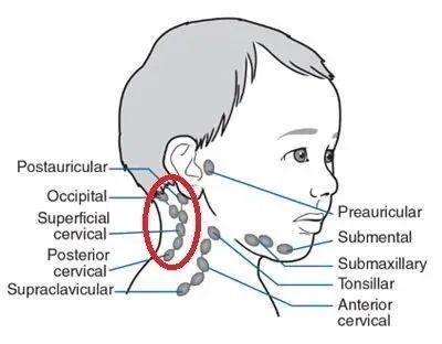 孩子耳后颈部长这种鼓包是什么问题需要担心吗
