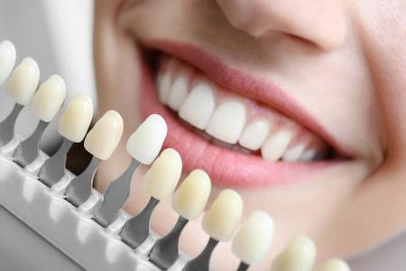 洗牙效果对比女人选择颜色的牙齿照片