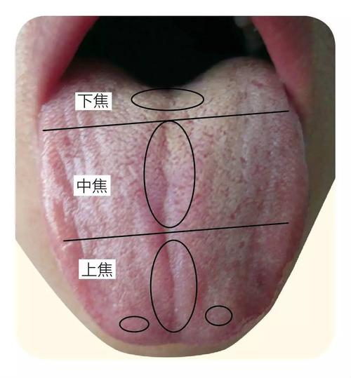 观舌知五脏兴衰,舌头出现这4种征象,您需要注意了!