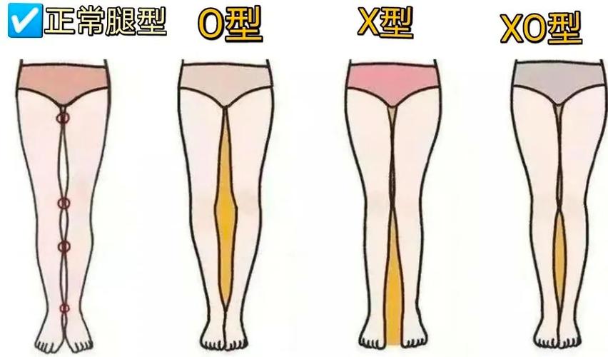 大致可以分为四种腿型:自然站立时,观察膝盖和脚踝之间能否并拢,有没