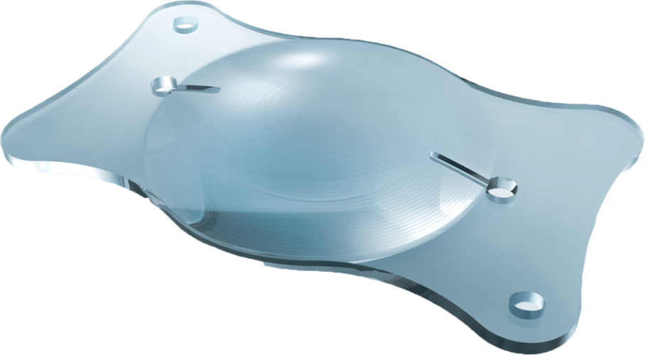 满足个性化视觉需求北京希玛眼科甄选德国蔡司制造的非球面人工晶状体