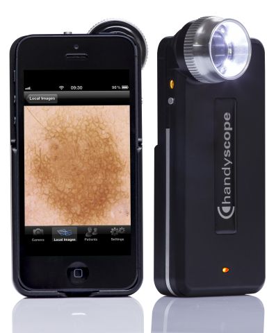 fotofinder发布handyscope03用于iphone5的手机皮肤镜