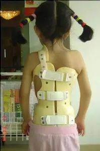 染上坏习惯8岁娃脊柱侧弯成折叠人医生告诫别再这样抱孩子