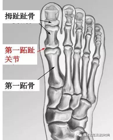 让我们进一步了解拇外翻的解剖结构:拇趾和第一跖骨形成了第一跖趾