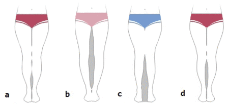 图a(正常腿型)       为了确定你的腿型,与上面显示的图片进行比较.