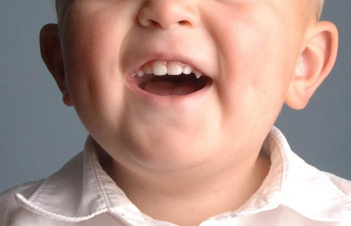 四种喂养方法影响宝宝牙齿健康