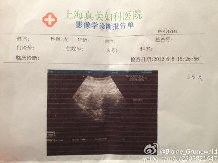 袁莉发微博否认怀孕丈夫6月曾晒胎儿b超照图