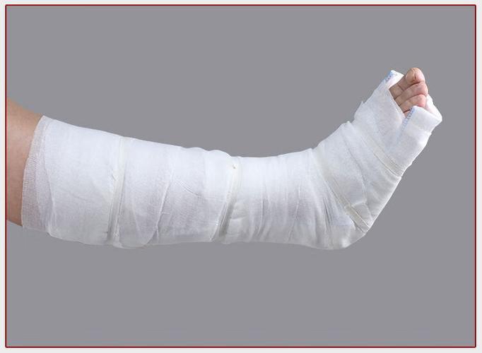 【jd健康】骨折石膏固定夹板高分子石膏绷带手臂腕肘关节膝盖脚踝关节