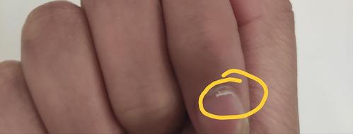 指甲上的这层皮是什么