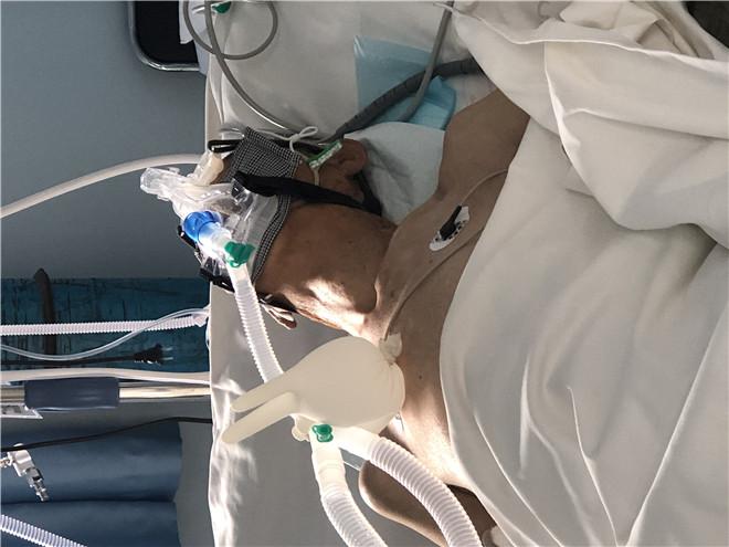 记内蒙古自治区中医医院icu成功治疗呼吸心跳骤停气管插管术后患者