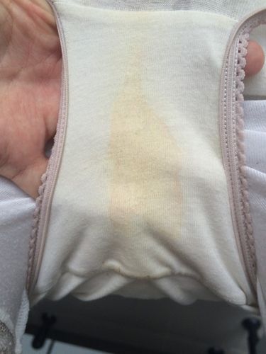 怀孕13周 在底裤上看白带这种颜色.用纸巾搽什么颜色都没有.