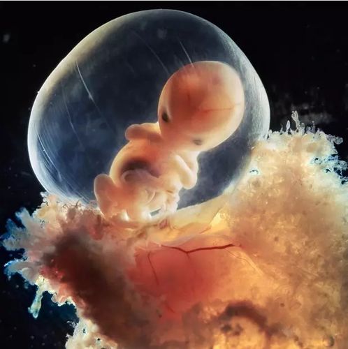 图片显示的是8周大的胎儿.