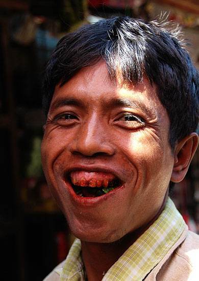 槟榔吃多了的人的照片 男人槟榔吃多了会杀精吗