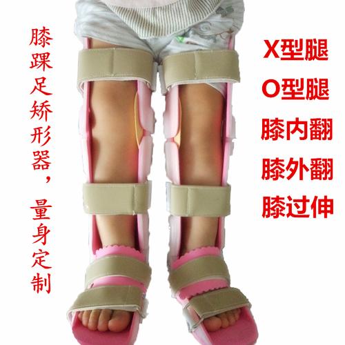 儿童xo型腿矫正 膝踝足支具 膝内翻 膝外翻 矫形器 私人订制支具