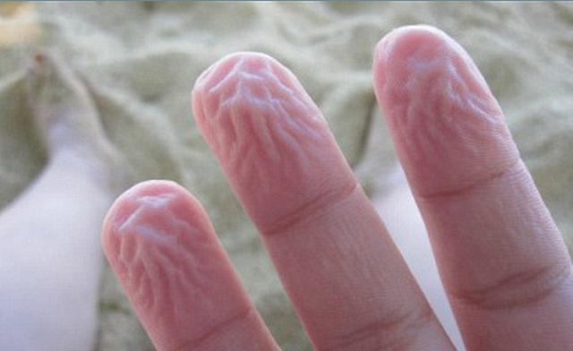 为什么手指泡水太久会变皱?