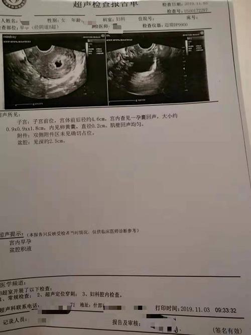 医院b超显示蒋女士已怀孕