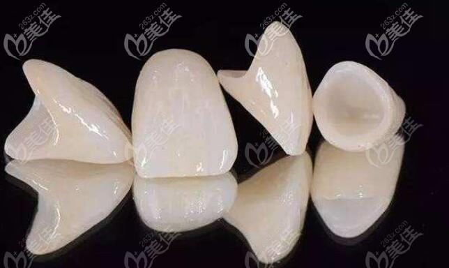 爱尔创全瓷牙主要分几个等级它的质量在国产里是第几名