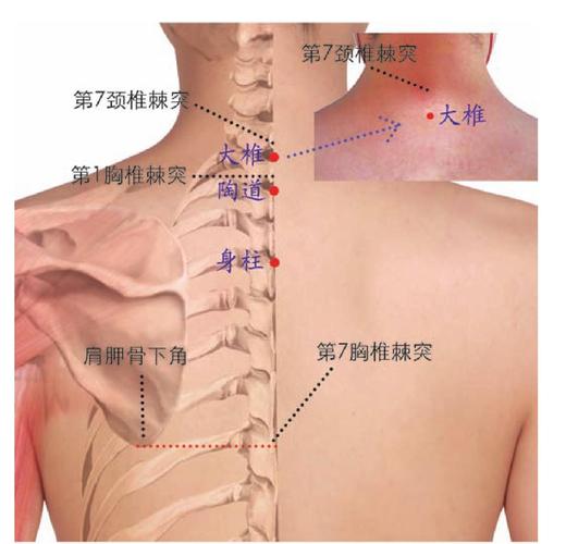【国标定位】在脊柱区,第3胸椎棘突下凹陷中,后正中线上(图2-100).