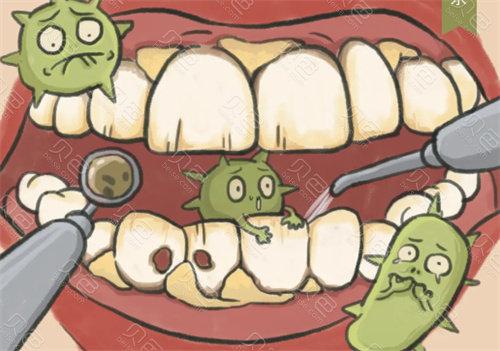 牙齿细菌图