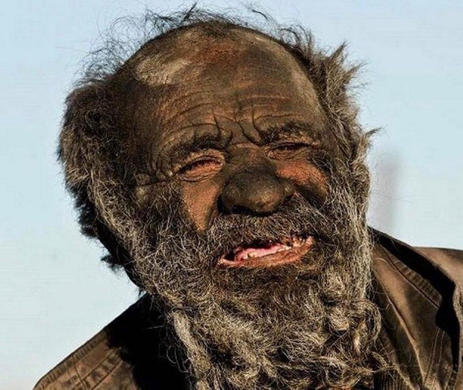 世界上最脏的人在伊朗去世,享年94岁! 他全身被烟灰覆盖,60多年来没有