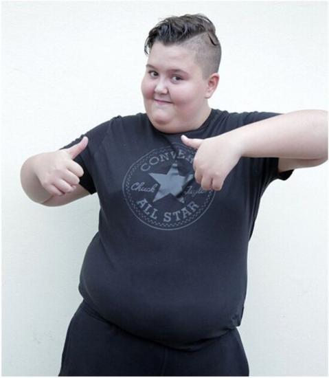 英14岁肥胖少年拒绝节食减肥:会毁了我的童年