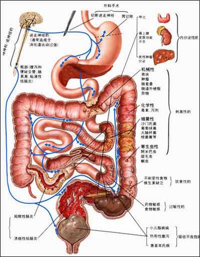 剖析胃 胃出血的预防