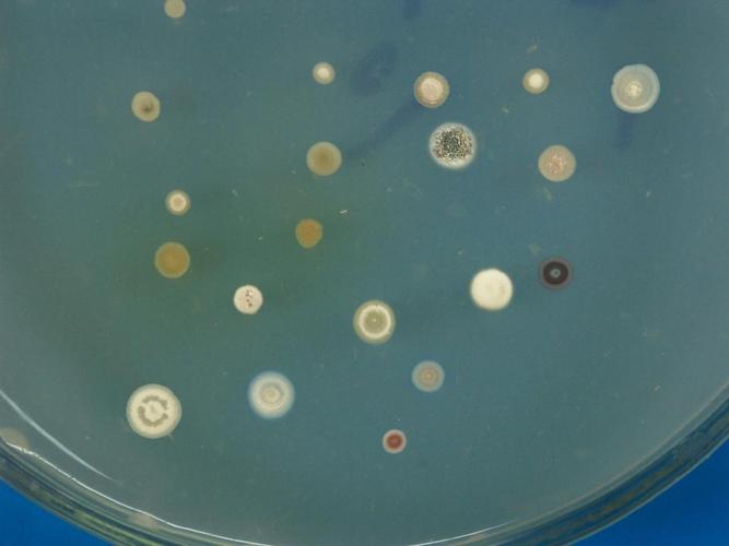 实验四 微生物的菌落形态观察,平板菌落计数及菌种保藏(张理珉)ppt