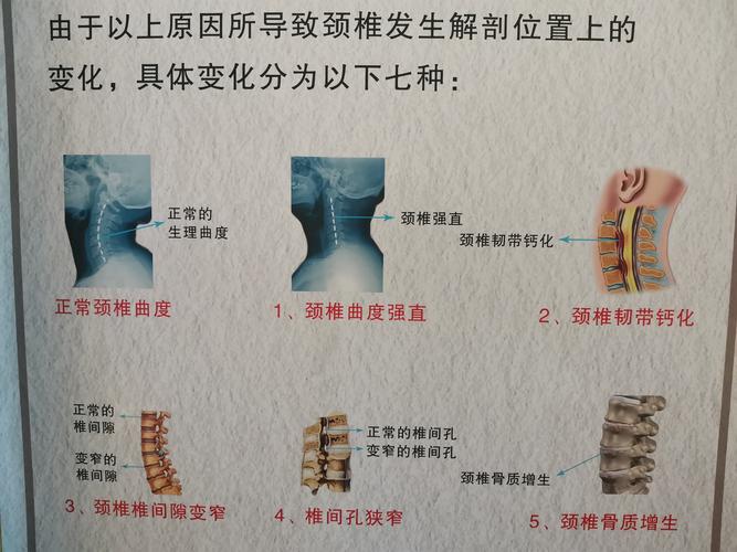 再看看正常颈椎和病理颈椎的结构改变图