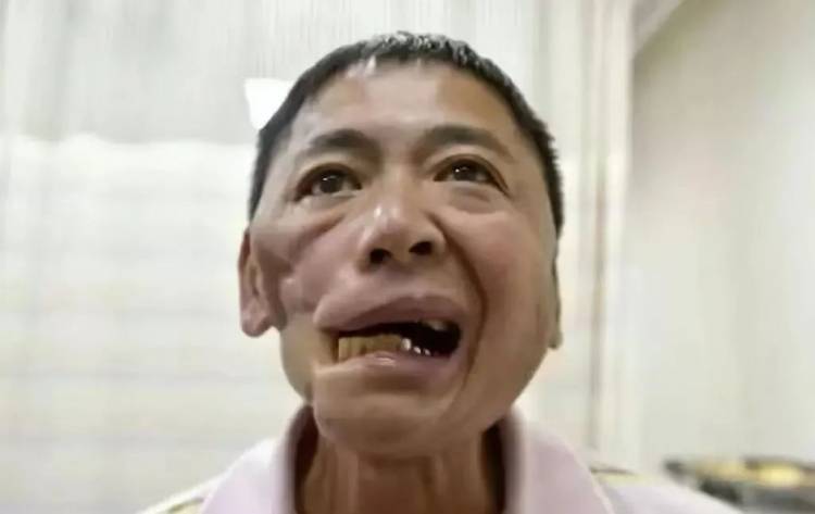 《槟榔王国中的"割脸人"》 "他们被割掉舌头,他们被切去牙床,狰狞的
