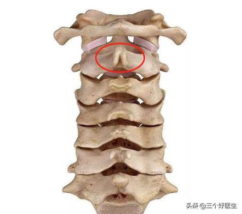 c2:第二颈椎的特征是棘突最大且分叉,所以一般触摸棘突.