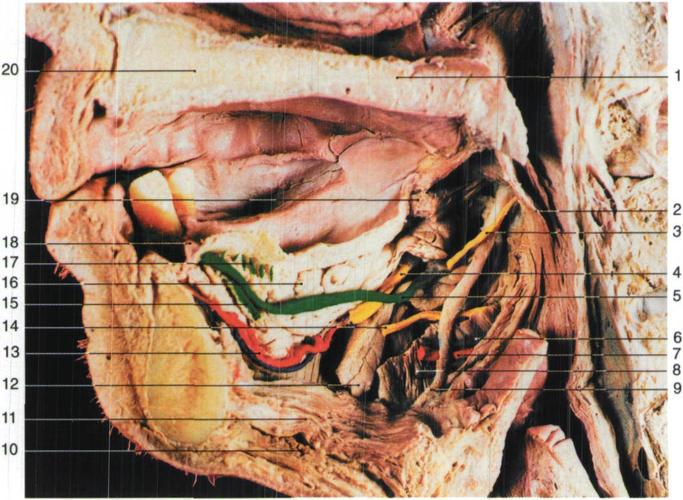 口腔腺(内侧面观)-颌面口腔应用解剖-医学