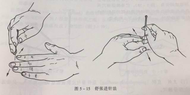 重庆六合学校:自学针灸的你,进针手法掌握清楚了吗