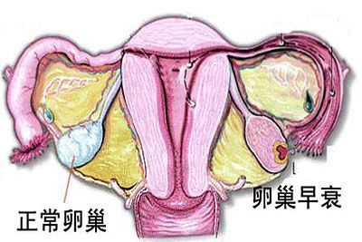 一些外部的提示(如痛经,长斑,白带异常等等)时,很有可能是卵巢的预警