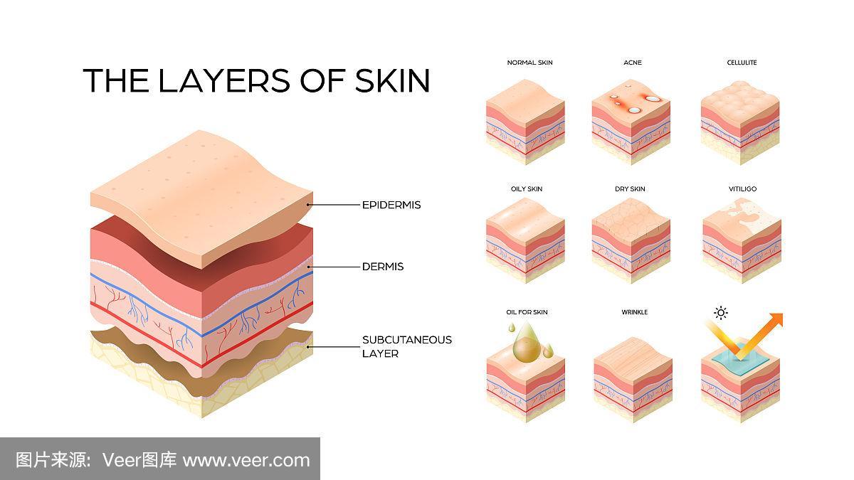 设置不同类型皮肤分层横截面人体皮肤结构护肤医学概念平展水平