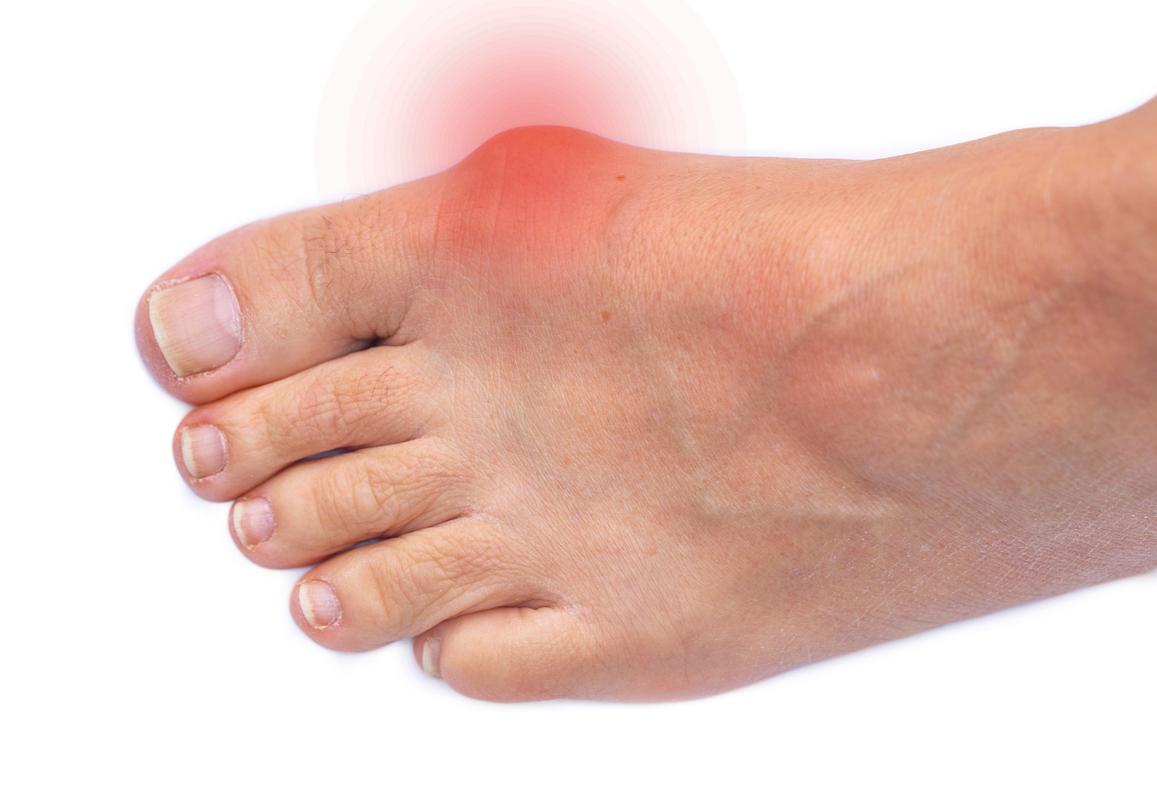 引起脚大拇指关节肿疼的原因很多,在临床比较多见的是以下几方面.