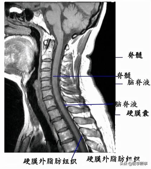 脊柱详细解剖,高清图文_颈椎