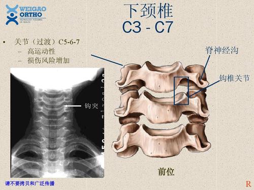 卫生 临床医学 脊柱解剖基础ppt 下颈椎 c3 - c7   关节(过渡)c5-6-7