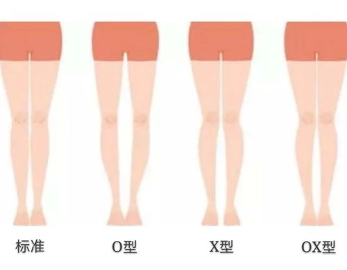 各种腿型如何选裤型