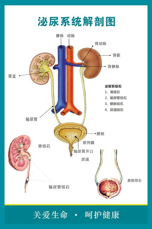 景超富康医院人体泌尿系统结构示意图海报男女生殖结石挂图泌尿系统