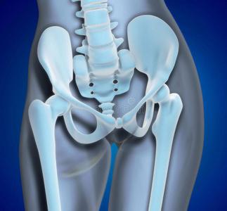渲染医学插图的骨盆骨男性骨盆模型髋关节置换植入物安装在骨盆骨