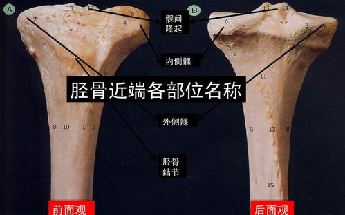 髁间 隆起 内侧髁 胫骨近端各部位名称 外侧髁 胫骨 结节 前面观 后面