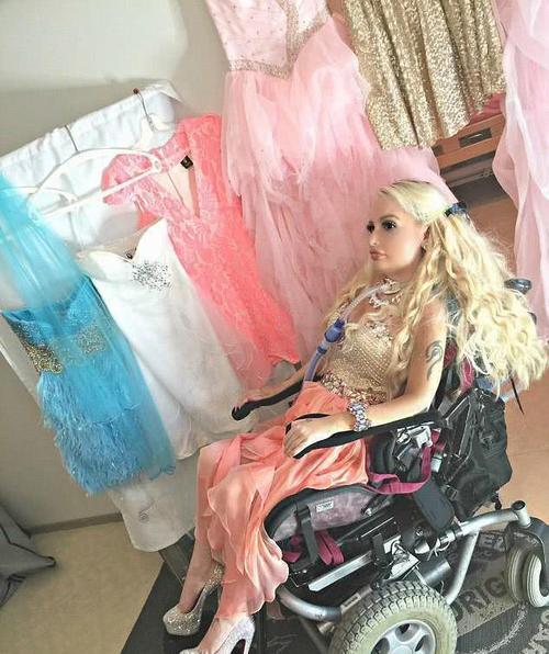芬兰四肢瘫痪女子活出精彩扮真人芭比激励众网友