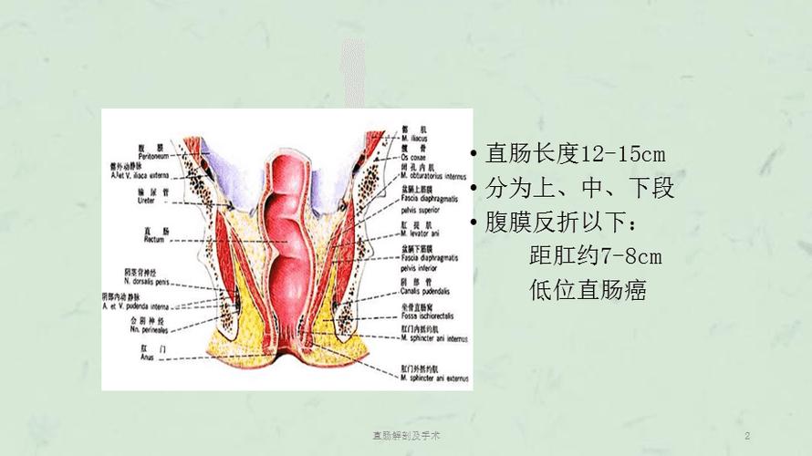 直肠解剖及手术课件
