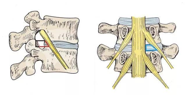 麻醉科医师900问椎间孔与脊神经干阻滞有何关系