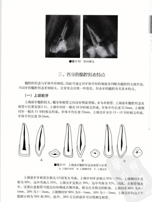 各牙髓腔根管形态位置