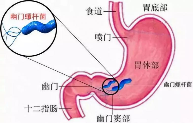 易黏附在幽门附近的胃窦部的黏膜上,位于胃黏液的深层,不与胃酸直接